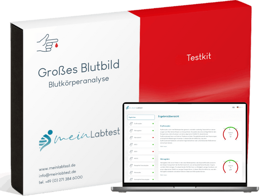 Meinlabtest Großes Blutbild — Heimtest-Kit